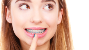 Overcrowded Teeth Treatment – 4 Ingenious Ways Of Fixing Crooked Or Overcrowded Teeth