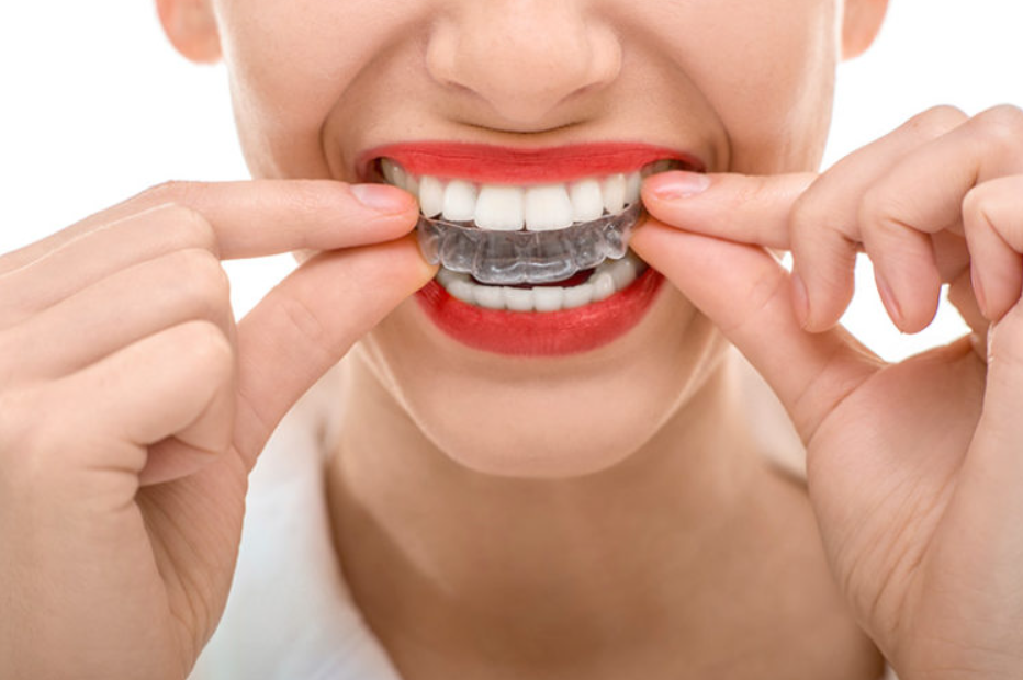 invisalign treatment in Duncan