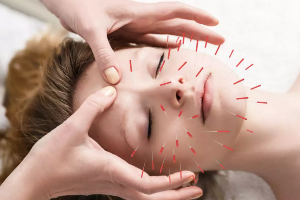 Get Acupuncture Treatment To Cure Many Diseases