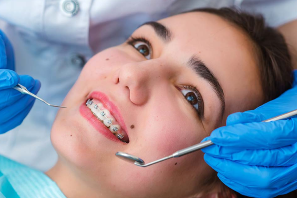 Top Benefits of Orthodontic Services in Victoria