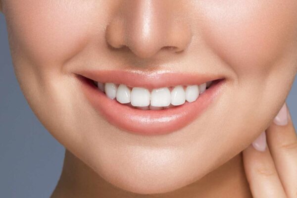 The Ultimate Reasons To Use Porcelain Dental Veneers
