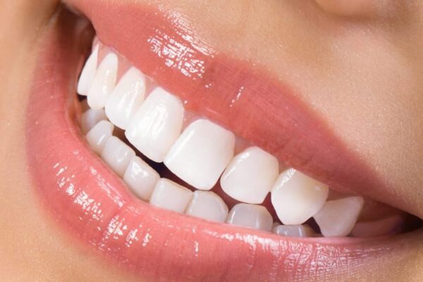 Dental Restoration Service in Taree: What to Expect
