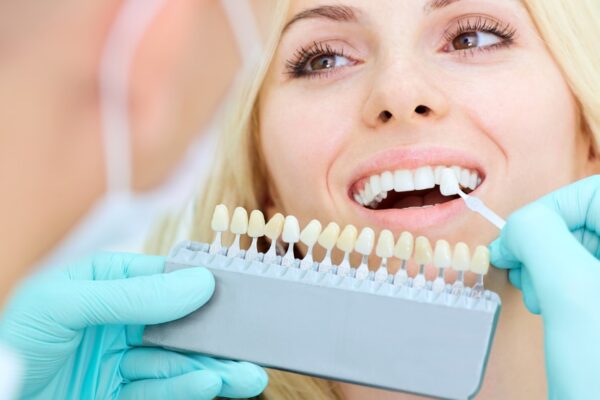 The Beauty of Subtlety: How Natural-Looking Veneers Can Improve Your Smile?